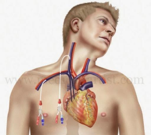 Tài liệu Hướng dẫn phòng ngừa nhiễm khuẩn huyết trên người bệnh đặt catheter trong lòng mạch