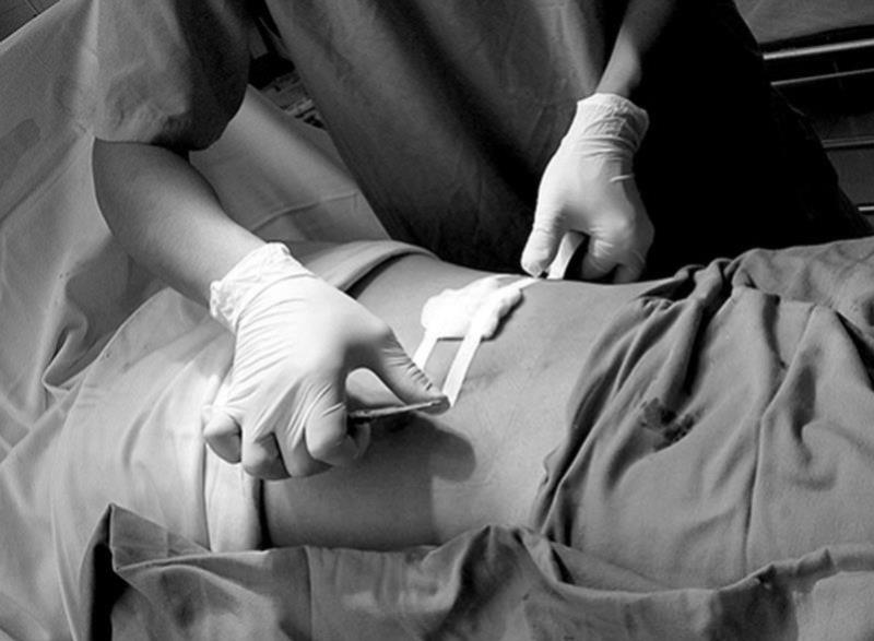 Tài liệu Hướng dẫn phòng ngừa nhiễm khuẩn vết mổ